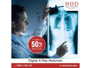 When is a Digital X-Ray Abdomen Recommended?