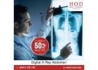 When is a Digital X-Ray Abdomen Recommended?