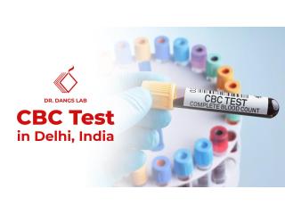 CBC Test in Delhi, India | Dr. Dangs Lab