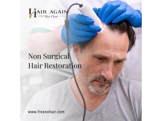 Non surgical hair restoration