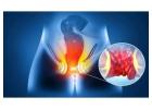 Advanced Fistula Treatment for Better Recovery in Kolkata  