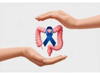 Colon Cancer Treatment in Noida | Dr. Manish Singhal Care