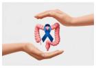 Colon Cancer Treatment in Noida | Dr. Manish Singhal Care