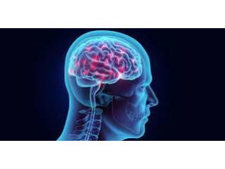 Brain Hemorrhage Treatment with Advanced Interventional Radiology