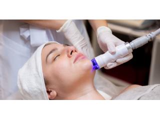 Microdermabrasion Therapy by Body Laser Therapy BV