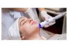Microdermabrasion Therapy by Body Laser Therapy BV
