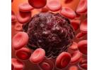 Blood Cancer Specialist in Hyderabad
