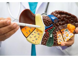 Complicated Cirrhosis Treatment in Ahmedabad by Dr. Jigar Patel