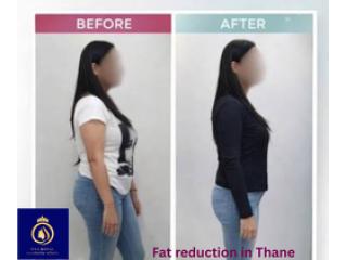 Achieve Your Body Goals with Fat Reduction in Thane – DNA Royal.