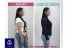 Achieve Your Body Goals with Fat Reduction in Thane – DNA Royal.