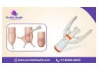 Affordable Circumcision Surgery Cost in Bangalore - Orchidz Health