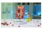 Dr. Kyriakos Neofytou: Hemorrhoids Treatment for Effective Relief and Better Comfort