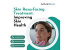 Skin Resurfacing Treatment: Improving Skin Health