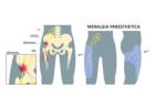 Meralgia Paresthetica Treatment in Gurgaon : Expert Physiotherapists in Gurgaon