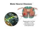 Motor Neuron Disease Treatment in Gurgaon : Expert Physiotherapy Services for Motor Neuron Disease 