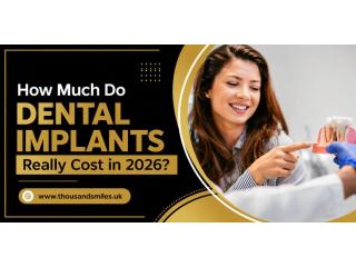 How Much Do Dental Implants Really Cost in 2026?