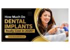 How Much Do Dental Implants Really Cost in 2026?