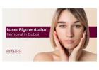 Laser Pigmentation Removal in Dubai, UAE