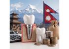 Dental Implant Cost in Nepal at Studio Dentale