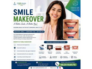 Smile Makeover Treatment in Ahmedabad | DR. Manish Shah