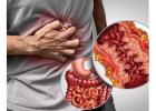 Dr. Jigar Patel for Advanced IBD Treatment in Ahmedabad