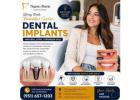 Dental Implants Treatment in Perris | Nuevo Perris Dental