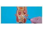 Expert Care with the Best Fistula Surgeon in Kolkata