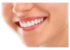Restorative Dentist Burton – Advanced Dental Care for a Healthier Smile
