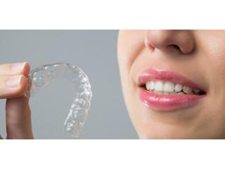 Invisible Braces Prices