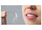 Invisible Braces Prices