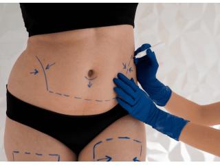 Non-surgical Liposuction in Dubai - Dr. Mohan Plastic Surgeon