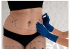 Non-surgical Liposuction in Dubai - Dr. Mohan Plastic Surgeon