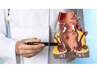 Advanced Care for Pilonidal Sinus & Piles
