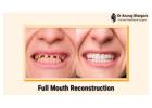 Full Mouth Reconstruction: Restore Your Smile | Dr. Anurag Bhargava