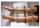 Best Height Increase Surgeon in Delhi for Safe and Effective Treatment