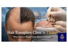 Professional Hair Transplant Clinic in Thane – DNA Royal.