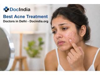 Best Acne Treatment Doctors in Delhi | Book Online - DocIndia
