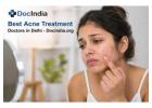 Best Acne Treatment Doctors in Delhi | Book Online - DocIndia