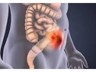 Advanced Hernia Care from a Skilled Surgeon in Dum Dum Park