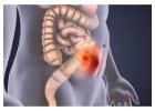 Advanced Hernia Care from a Skilled Surgeon in Dum Dum Park
