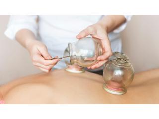 Why Choose Dry Cupping Therapy in Dubai?