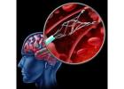 Stenting Operation for Improved Blood Flow Through Narrowed Arteries