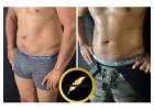 Awake High Definition Liposuction: Precision Sculpting, Fast Recovery