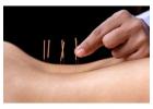 ¿Cuál es el Mejor Dolor de Cuello Tratamiento para Ti?