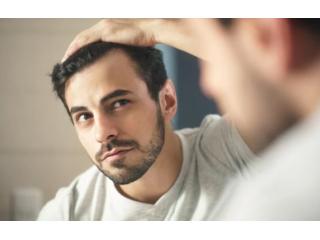 Hair Transplant Cost in Delhi – Get Expert Guidance Today