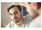 Hair Transplant Cost in Delhi – Get Expert Guidance Today