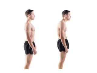Early Poor Posture Symptoms and Simple Ways to Improve Alignment