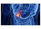 Dr. Nitin Bhel for Gallbladder Cancer Treatment in Ludhiana