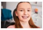 Teen Braces Midlothian VA: Helping Teens Build Confident Smiles