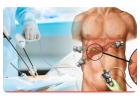Dr. Purnendu Roy for Laparoscopic Gallbladder Surgery Kolkata  